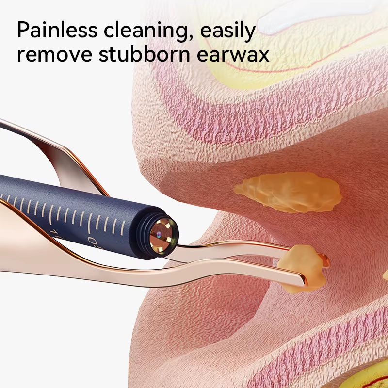 Upgraded Smart Visual Ear Wax Cleaner with Camera 800W HD Endoscope Multi-Functional Visual Ear Cleaning Tool Includes Storage