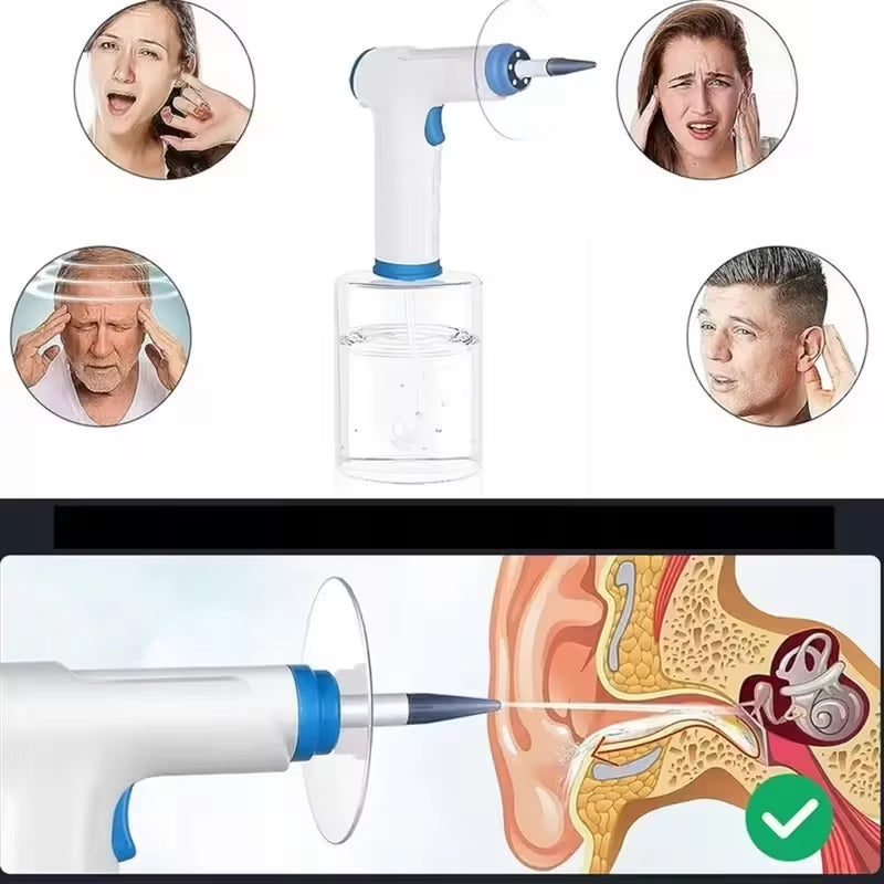 Electric Ear Cleaner with 4 Pressure Mode Electric Ear Cleaning Kit with 500Ml Capacity Water Tankwater Powerd Earwax Removal